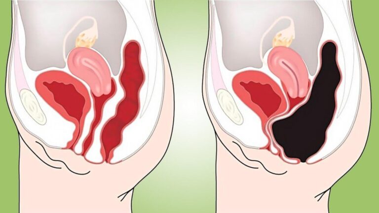 Questo semplice gesto trasforma la tua salute: scopri il segreto per un colon felice…
