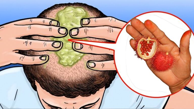 11 alimenti per avere capelli più folti in soli 7 giorni! Scopri di più ora!