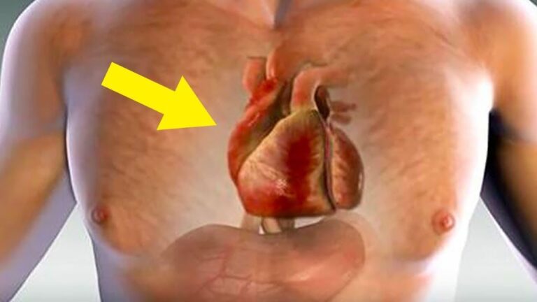 14 Segni Preoccupanti: Scopri Come Il Tuo Corpo Avvisa Prima Di Un Infarto