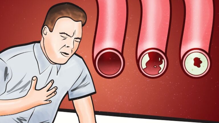8 alimenti per ripulire le arterie e proteggere il cuore subito!
