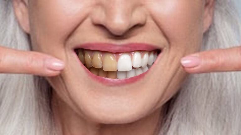 11 modi naturali per sbiancare i denti a qualsiasi età: scopri il migliore!