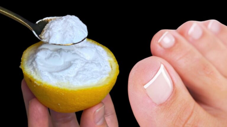 Rimedi naturali: 5 passaggi per eliminare funghi unghie in modo efficace!