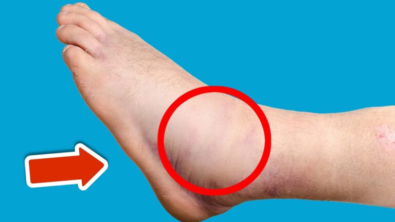 Scopri 5 vitamine per eliminare gonfiori in piedi e gambe in modo naturale!