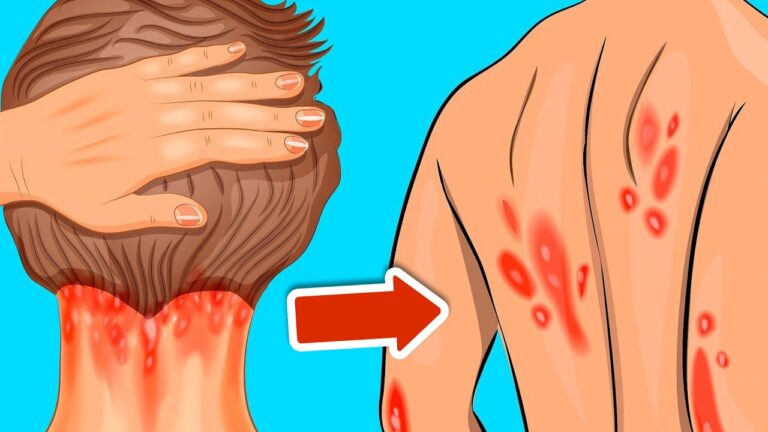 Scopri 10 segnali di carenza di vitamina D che non puoi ignorare!