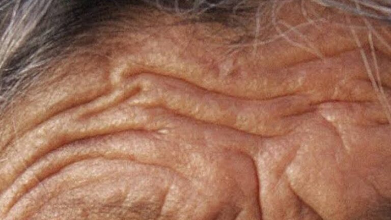 Scopri 5 rimedi naturali per ridurre le rughe in 5 minuti!