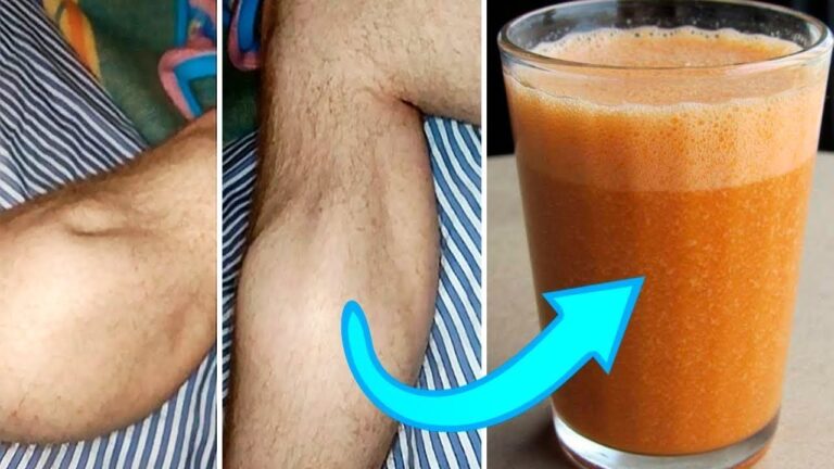 5 Soluzioni Efficaci per i Crampi Notturni alle Gambe da Provare Subito!