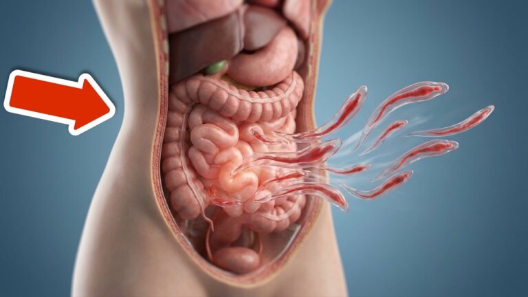 3 modi rapidi per eliminare i vermi intestinali e ritrovare il benessere!